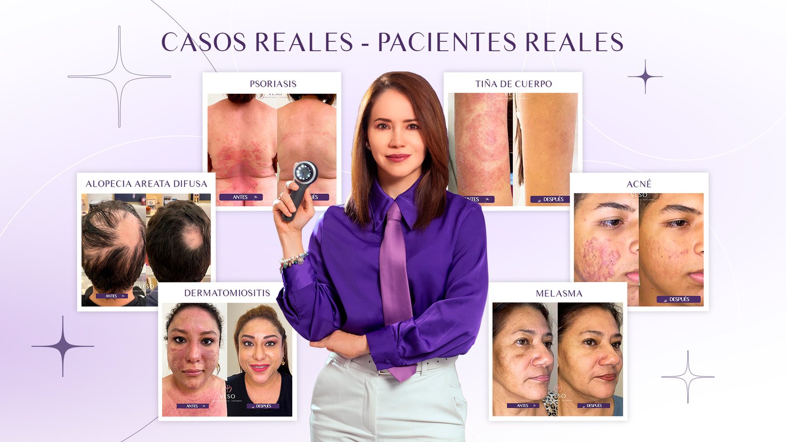 Casos reales - Pacientes reales